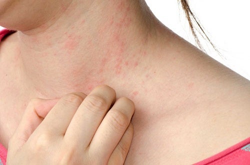 ¿Alergias? Prevención eliminando agentes desencadenantes en casa